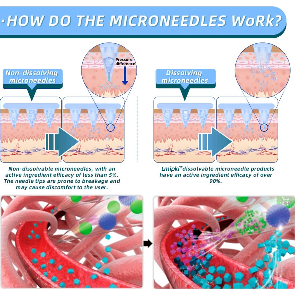 AUS Official Store: Lmipki® NIDDK-Tirzepatide Nano Microneedle Patch (Balance blood sugar, pain-free, with no side effects. Suitable for obesity and diabetes.)🔄